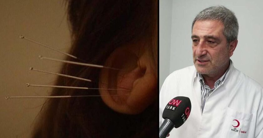 Akupunktur tedavisi nasıl uygulanır?